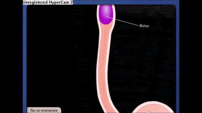 peristaltic movement of oesophagus on Make a GIF