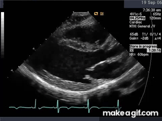 Normal Echo On Make A GIF