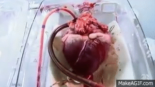 BEATING HEART TRANSPLANT HOSPITAL AMAZING VIDEO on Make a GIF