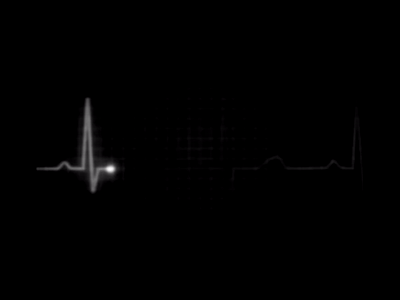 heart rate monitor flatline gif