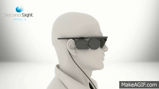 Second Sight EN 2012 Argus II Retinal Prosthesis System Artificial ...