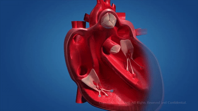 Human Circulatory System on Make a GIF