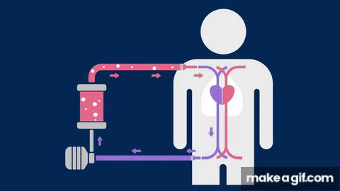 What is ECMO? - Lifesaving Support for Failing Organs (Including COVID ...