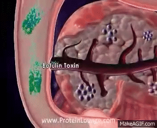 Botulinum toxin gif. Clostridium botulinum - PDF Free Download