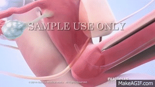 Insemination Gif 8 Insemination Gif 8