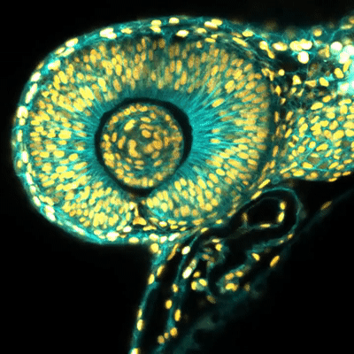 Hearbeat of an early zebrafish embryo on Make a GIF