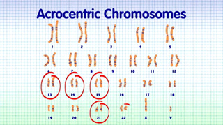 Understanding Chromosomal Translocation Robertsonian Translocation V1 2 On Make A Gif