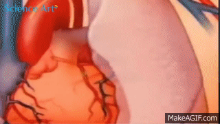 Balloon Angioplasty and Stenting Video Animation - Coronary Angiography and  Heart Stent Procedure on Make a GIF