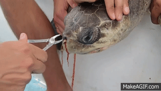 How Did Sea Turtle Get a Straw Up Its Nose?