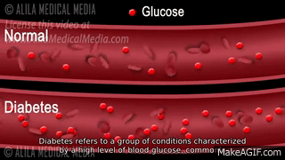 what is the pathophysiology of diabetes mellitus type 1