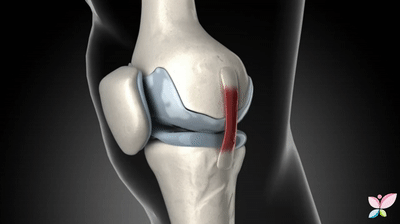 La articulación de la rodilla on Make a GIF