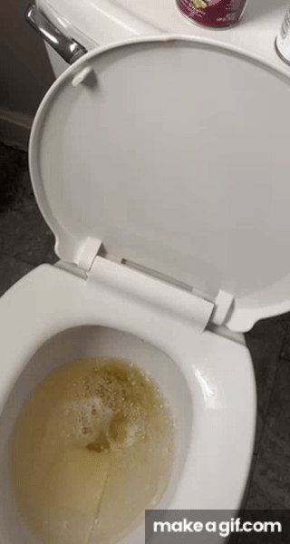 what does amniotic fluid look like in toilet