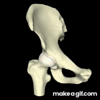 Hip impingement animation PINCER on Make a GIF