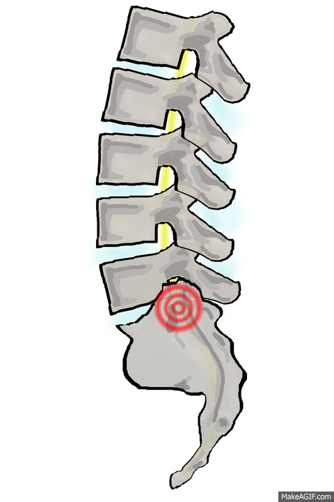 Spinal Tap Slot Demo