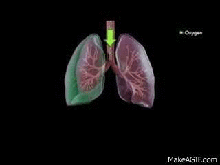 tension pneumothorax on Make a GIF