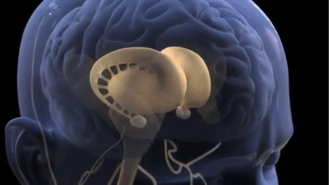 Pain Perception and the Human Brain on Make a GIF